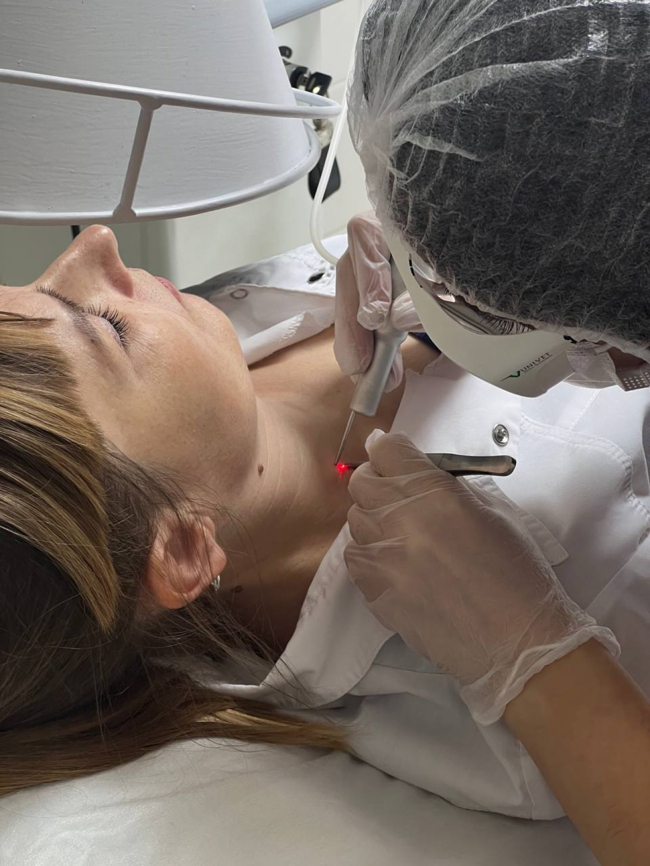 Удаление родинок, папиллом, бородавок, рубцов, шрамов, в т.ч. на половых органах