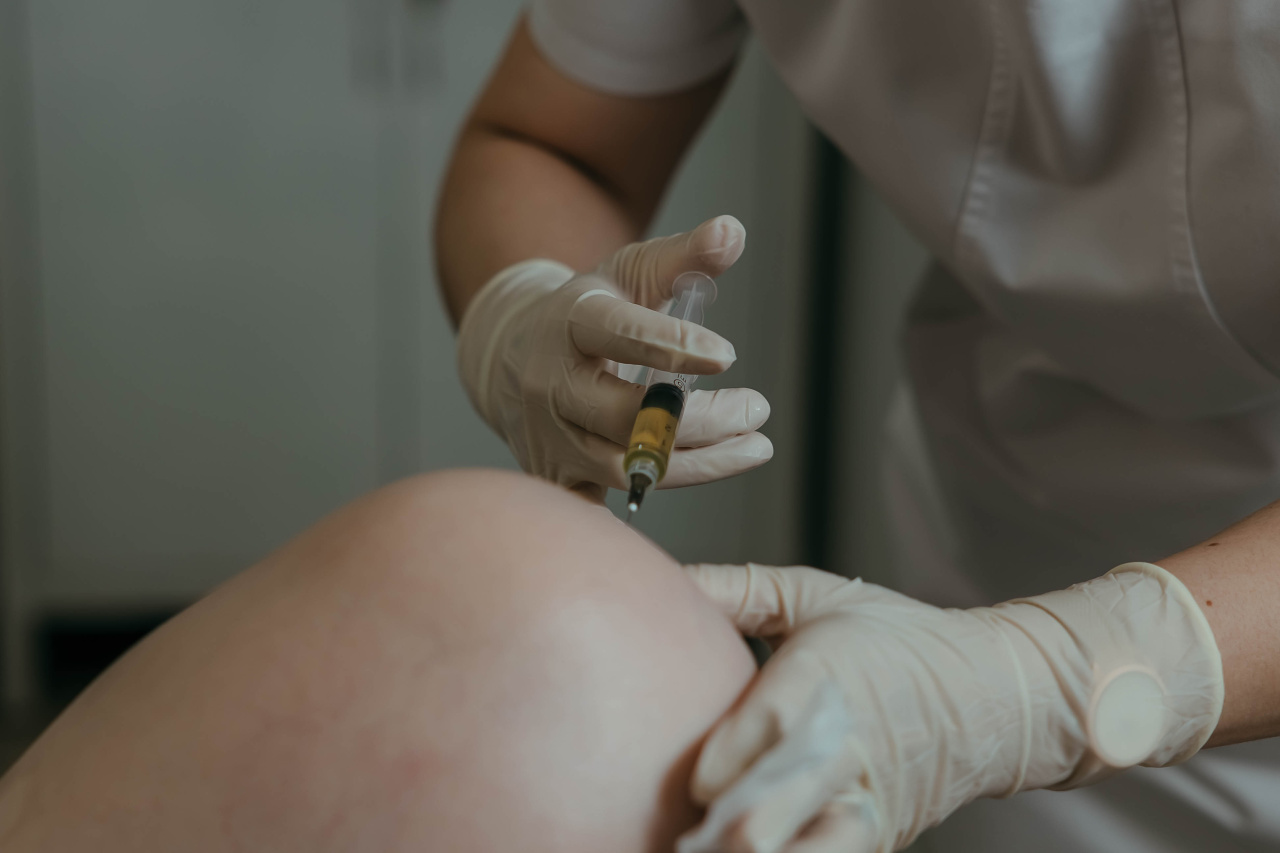 Пункция сустава